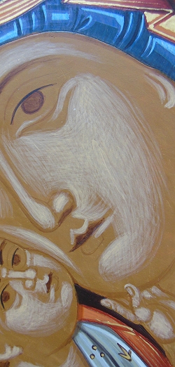 14 Haut erste (5) Detail kl